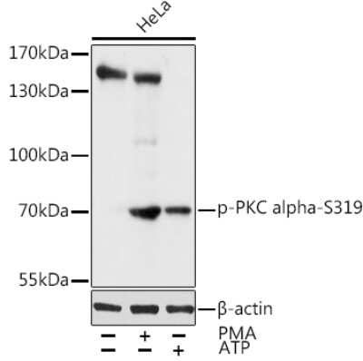 Western Blot: PKC alpha [p Ser319] Antibody [NBP3-05438] - Western blot analysis of extracts of HeLa cells, using PKC alpha antibody (NBP3-05438) at 1:1000 dilution.HeLa cells were treated by PMA/TPA (200 nM) at 37C for 30 minutes after serum-starvation overnight.Hela cells were treated by ATP(5 mM) at 30C for 1 hour. Secondary antibody: HRP Goat Anti-Rabbit IgG (H+L) at 1:10000 dilution. Lysates/proteins: 25ug per lane. Blocking buffer: 3% nonfat dry milk in TBST. Detection: ECL Basic Kit. Exposure time: 10s.